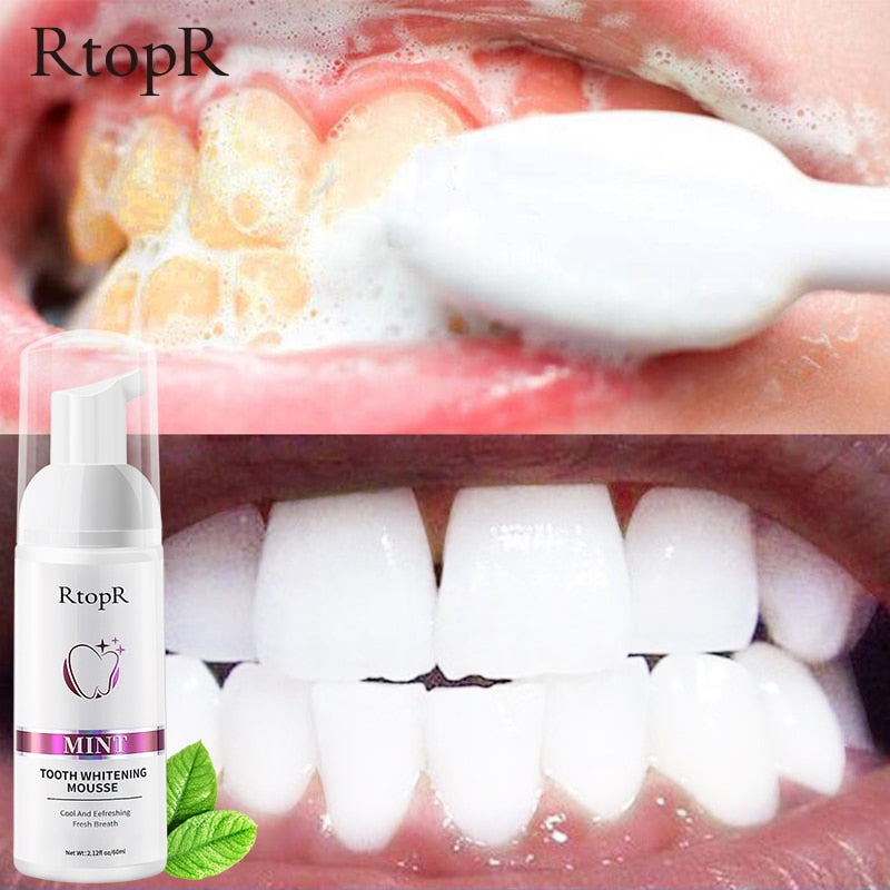 Tooth Whitening Mousse